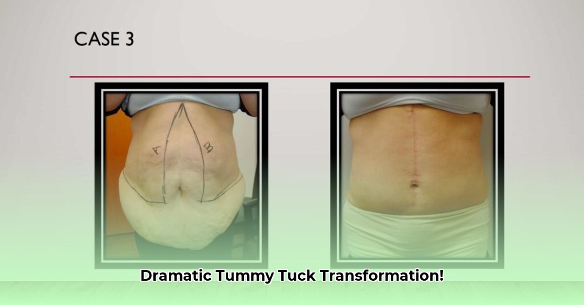 before-and-after-tummy-tuck-after-weight-loss